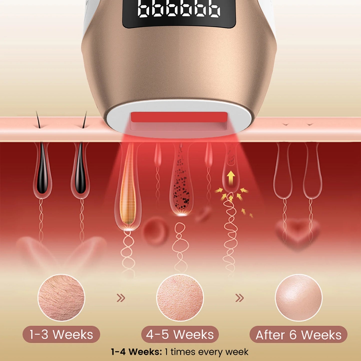 Laser Hair Removal,  IPL Hair Removal Device for Women and Men, 999999 Flashes for Arm Leg