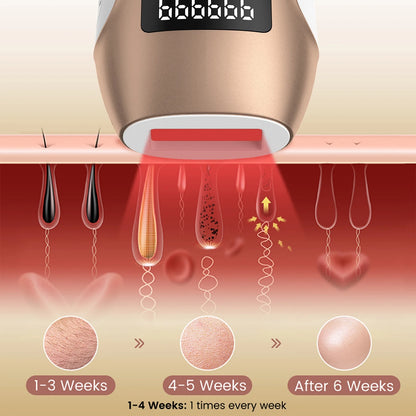 Laser Hair Removal,  IPL Hair Removal Device for Women and Men, 999999 Flashes for Arm Leg