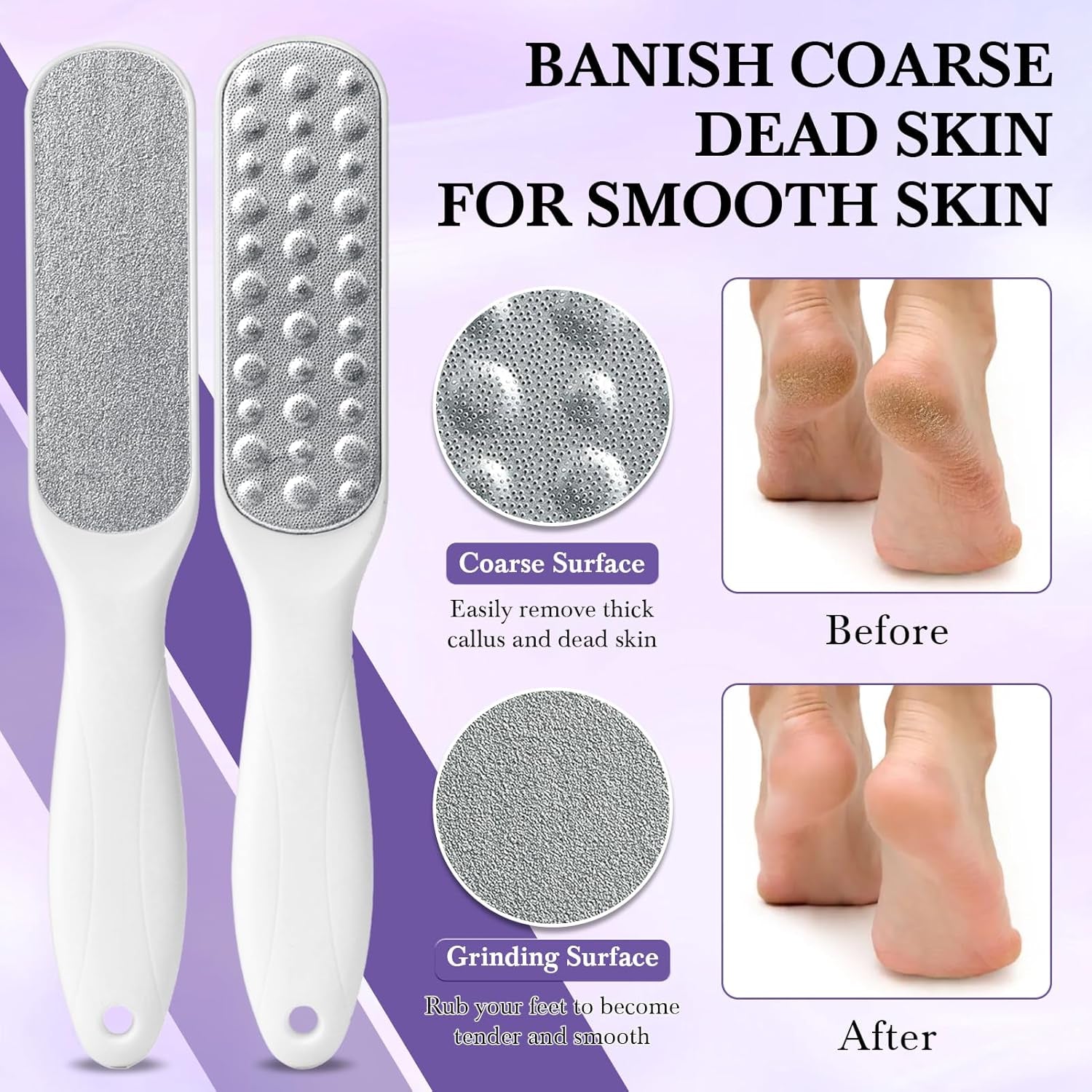 Foot Soak Set Callus Remover Pedicure Kit - Urea Cream 40%, Lavender Soak Salt with Epsom Salt & Foot File for Dead Skin, Foot Care Kit for Dry Cracked Heels at Home