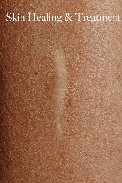 Thick Body Butter, Eczema, Moisturizing Dry, Itchy, Damaged Skin No Chemicals, 2Oz Made by a Man for His Lady