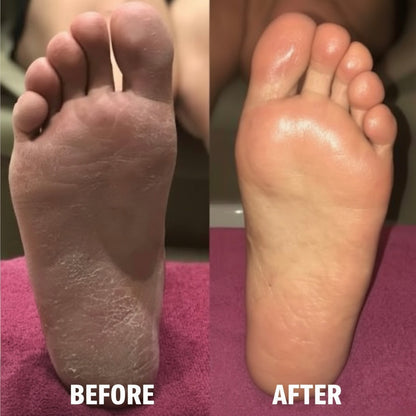 “Revive & Detox Foot Soak – Apple Cider Vinegar + Epsom Salt”
