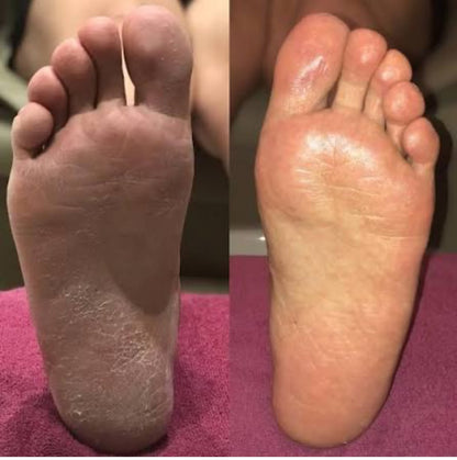 The Luxe Spa Foot Bundle