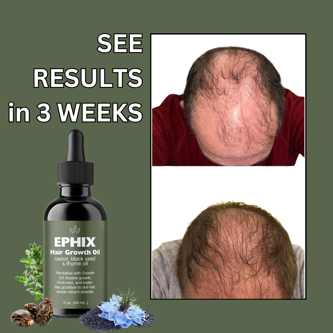 Hair Growth Oil with Castor, Black Seed, and Thyme Oil