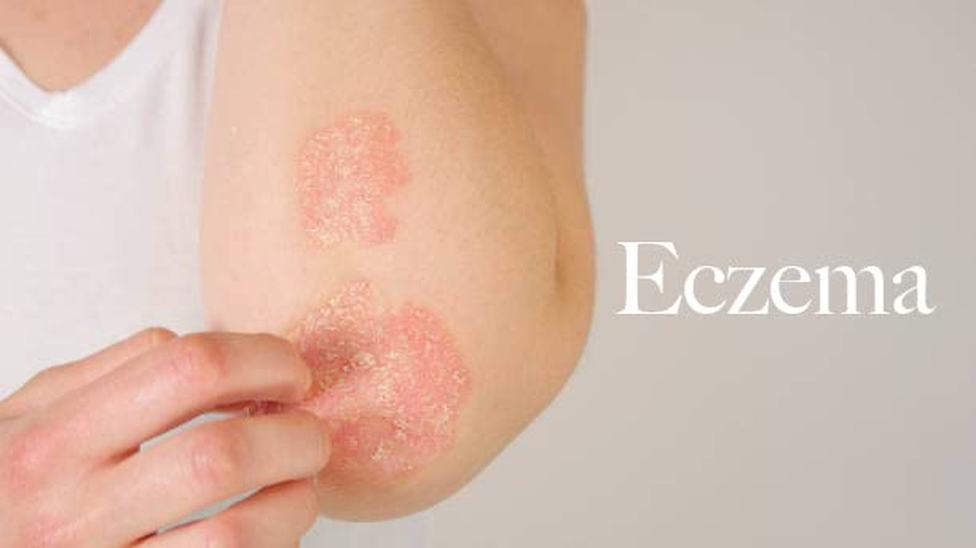 Thick Body Butter, Eczema, Moisturizing Dry, Itchy, Damaged Skin No Chemicals, 2Oz Made by a Man for His Lady