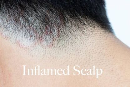 Thick Body Butter, Eczema, Moisturizing Dry, Itchy, Damaged Skin No Chemicals, 2Oz Made by a Man for His Lady