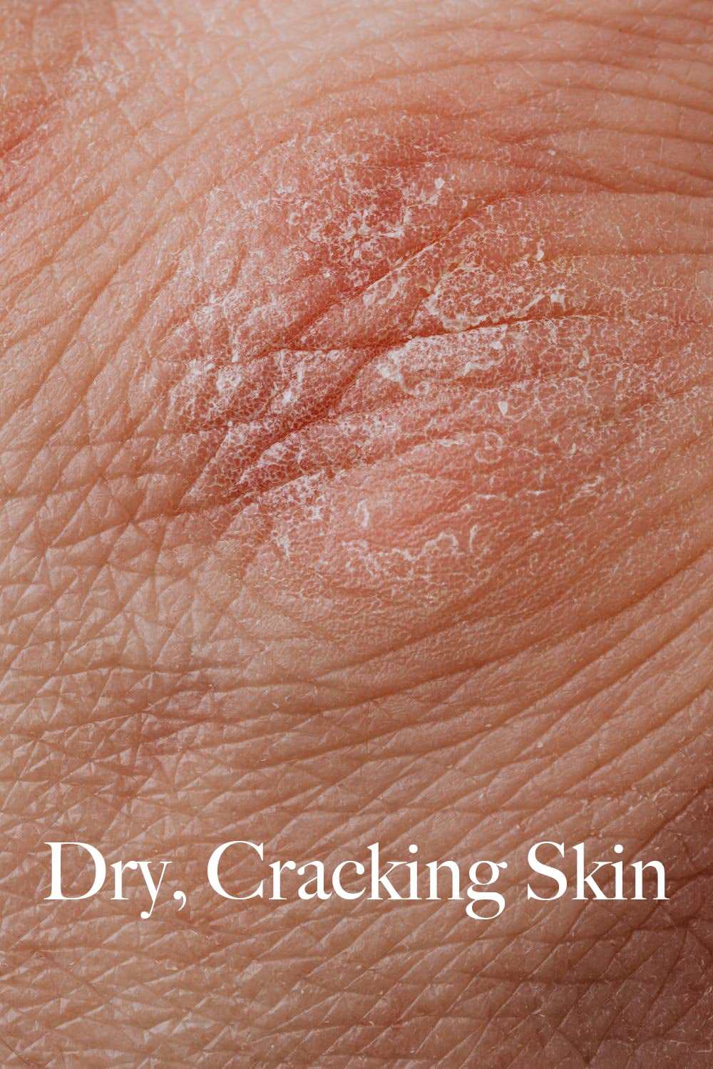 Thick Body Butter, Eczema, Moisturizing Dry, Itchy, Damaged Skin No Chemicals, 2Oz Made by a Man for His Lady