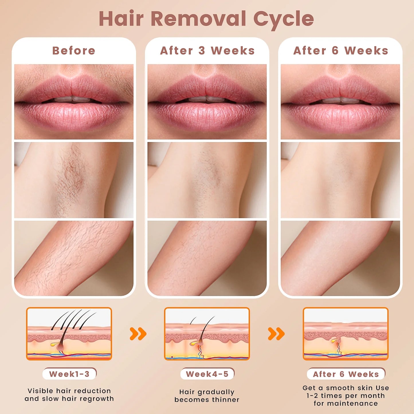 Laser Hair Removal,  IPL Hair Removal Device for Women and Men, 999999 Flashes for Arm Leg