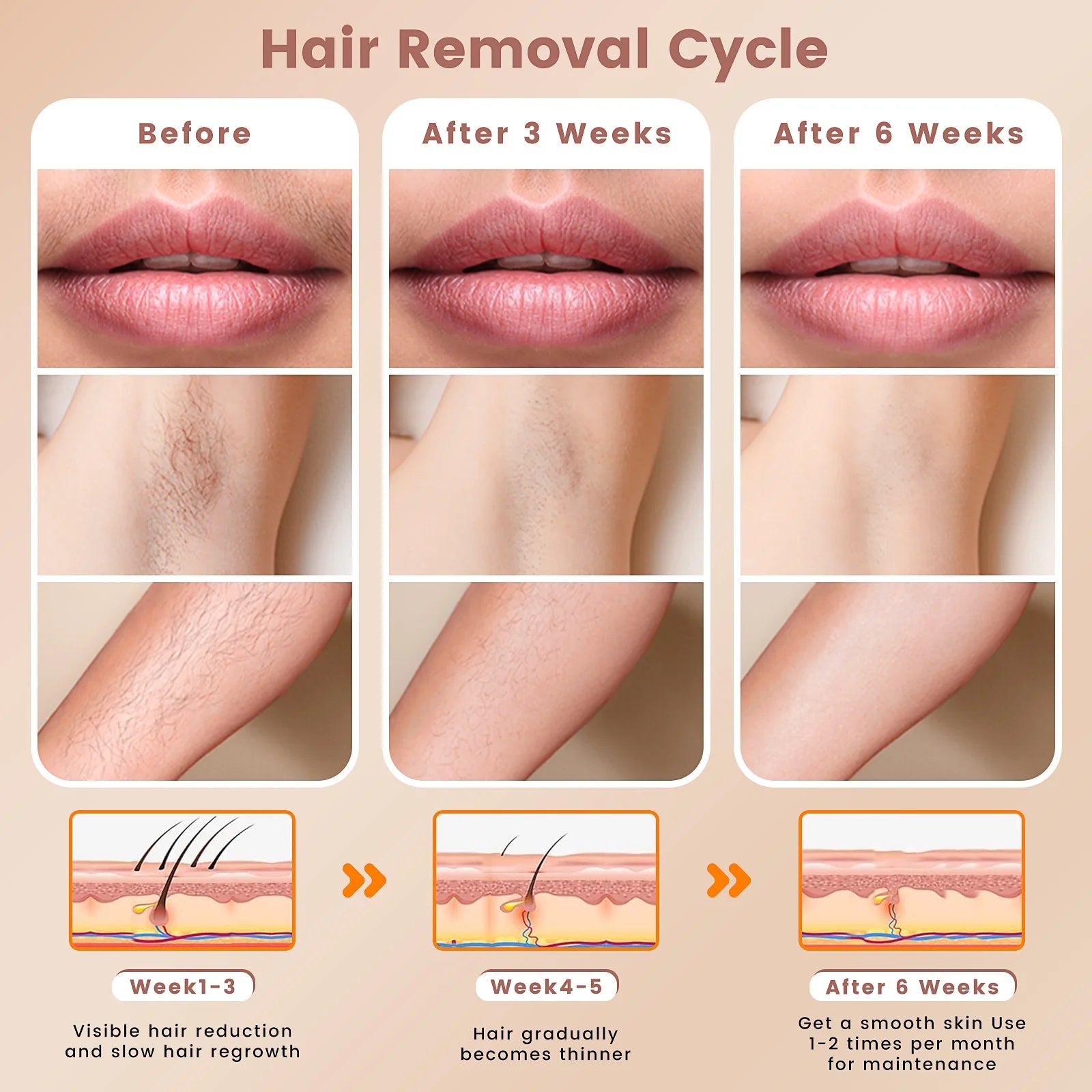 Laser Hair Removal,  IPL Hair Removal Device for Women and Men, 999999 Flashes for Arm Leg